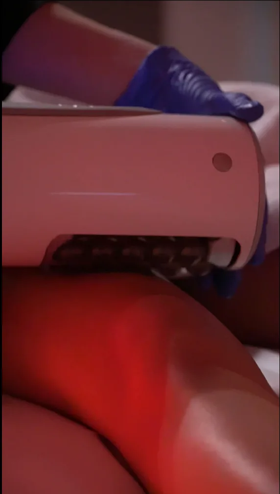 Endosphere Therapy, trattamento corpo - Aestetica Salvati Napoli