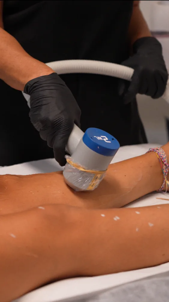 Epilazione laser corpo con laser a diodo - Aestetica Salvati Napoli